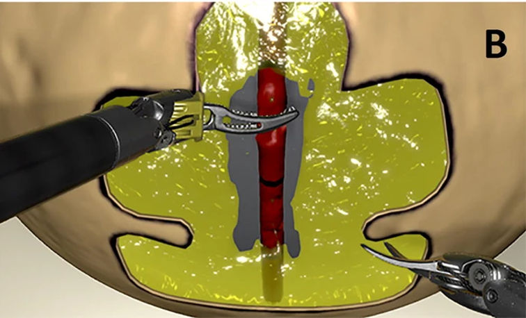 Dissektion Blutgefäss da Vinci Roboter mit Simulator üben